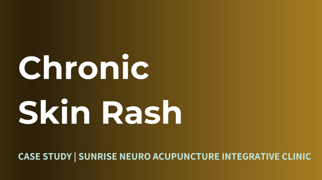 Skin Rash Treatment Sunrise Neuro Acupuncture Clinic Ottawa