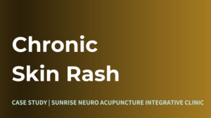 Skin Rash Treatment Sunrise Neuro Acupuncture Clinic Ottawa