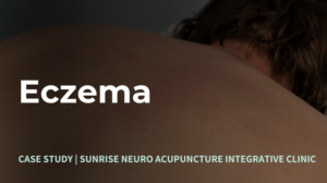 Eczema