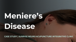 Menieres Disease Treatment Sunrise Neuro Acupuncture Clinic