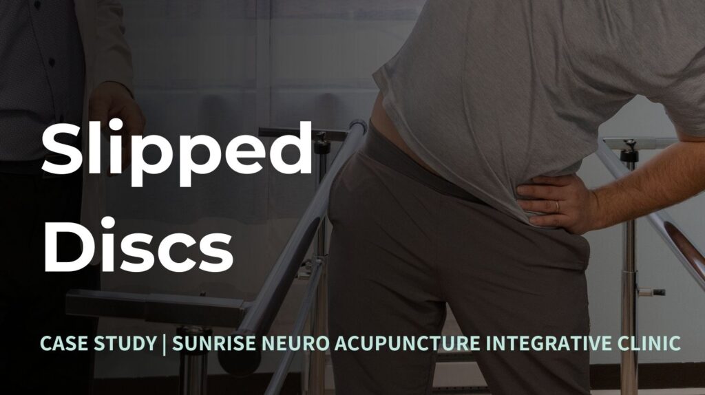 Neuro Acupuncture Clinic Ottawa