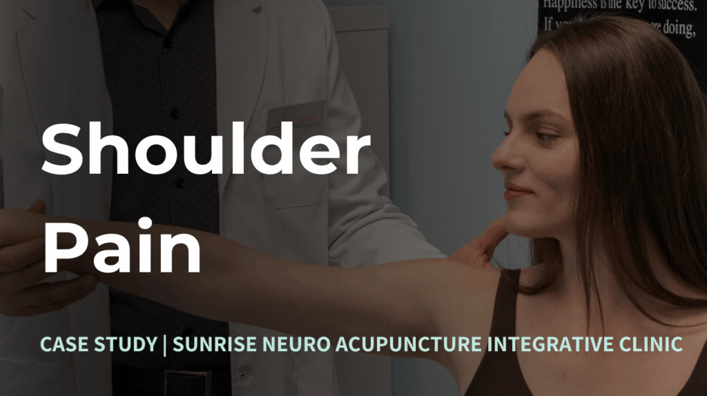 Acupuncture for Shoulder Pain by Denis Grounin performed at Sunrise Neuro Acupuncture INtegrative Clinic using Microcurrent-Assisted Acupuncture