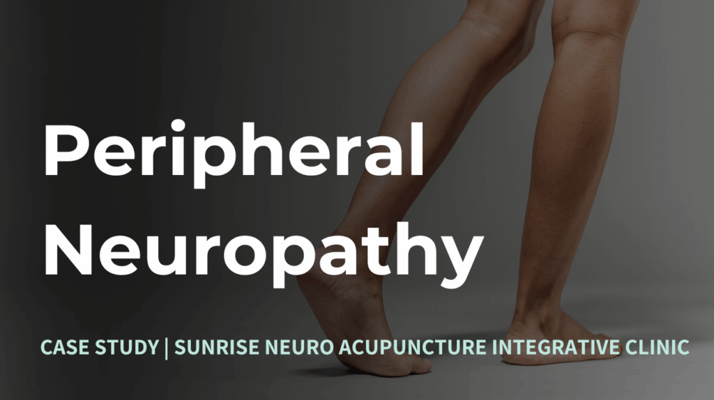 Peripheral Neuropathy Treatment with Neuro Acupuncture